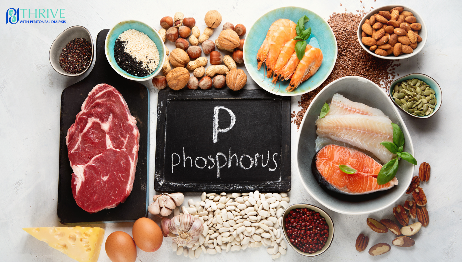 phosphorus-on-dialysis